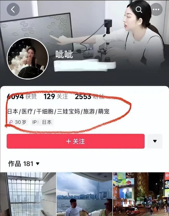 手术曝光脸色发黑引发担忧金龟子美容很享受pg电子模拟器免费试玩61岁王宁日本换血(图7)